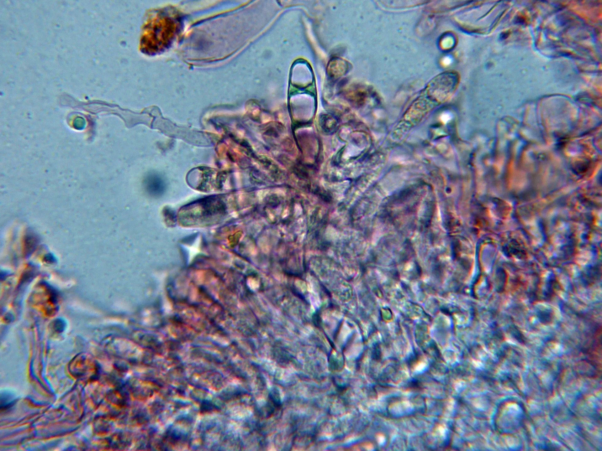 Microscopía de Sparassis crispa - 10 - Himenio-006